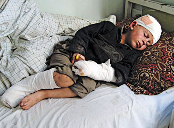 Injured child by NATO air strike in Kunar